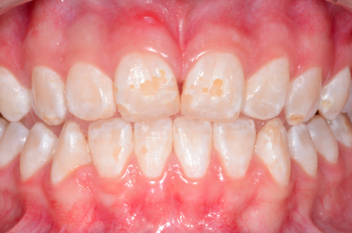 Site sobre dentes manchados
